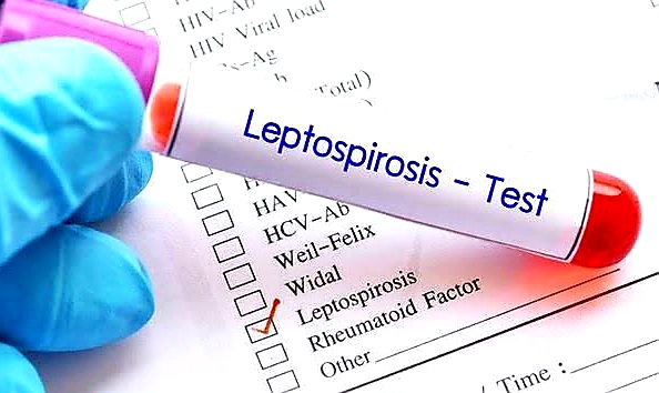 Leptospirosis, its causes, effects and  preventative approaches