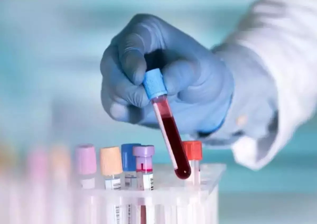 New blood test predicts heart disease risk for 30 years