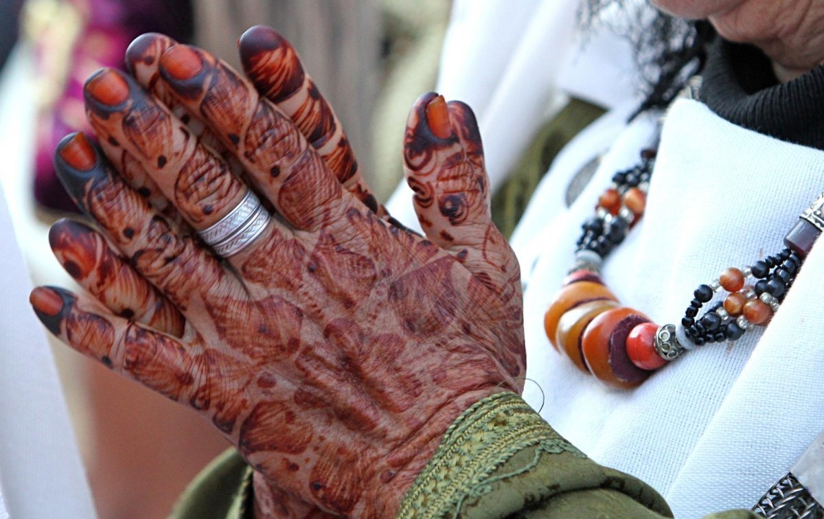 Natural henna shows promise as breakthrough treatment for liver fibrosis